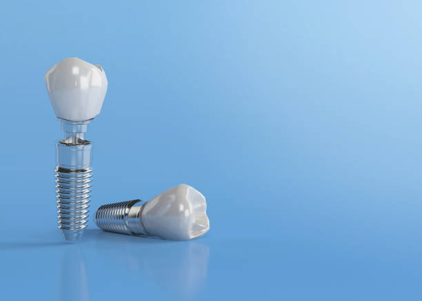actual photo of the different parts of a dental implant