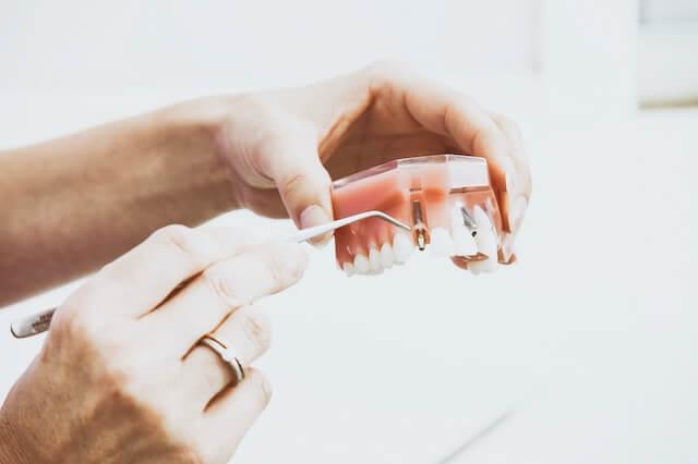 a hand holding dental model while showing how dental implants are installed